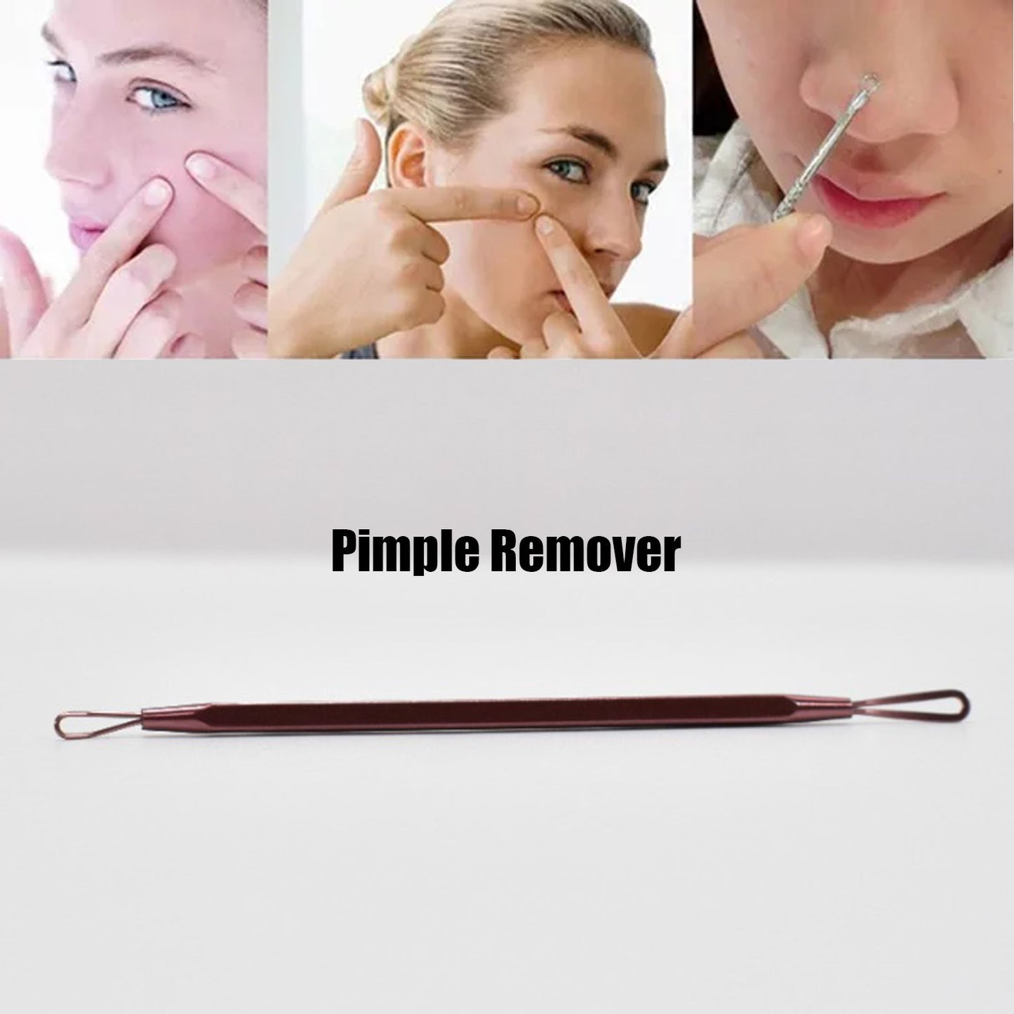 1386 Blackhead Remover Comedone Extractor Tool - Dual Loop Whitehead Blemish Acne Removal - Skin, Facial, Pimple